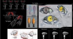 9.-Pulsar-200NS-Detailing-in-Design-IV